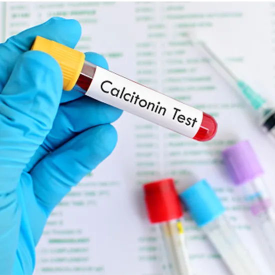 serum calcitonin Test